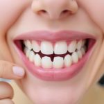 Эстетическая стоматология: современные методы, делая улыбку идеальной